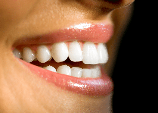 برای داشتن دندان و لثه سالم چه کارهایی باید انجام داد؟