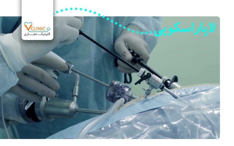 لاپاراسکوپی به کمک ربات